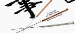 Acupuncture – A Patient’s Perspective