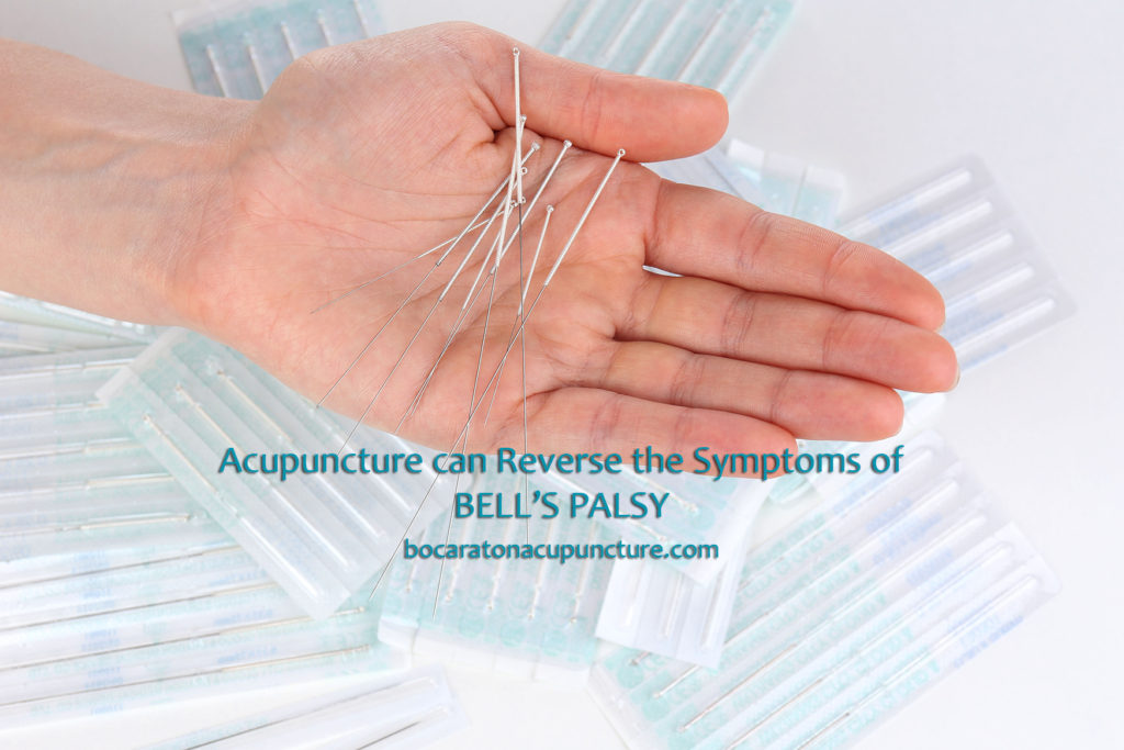  Boca Raton Acupuncture