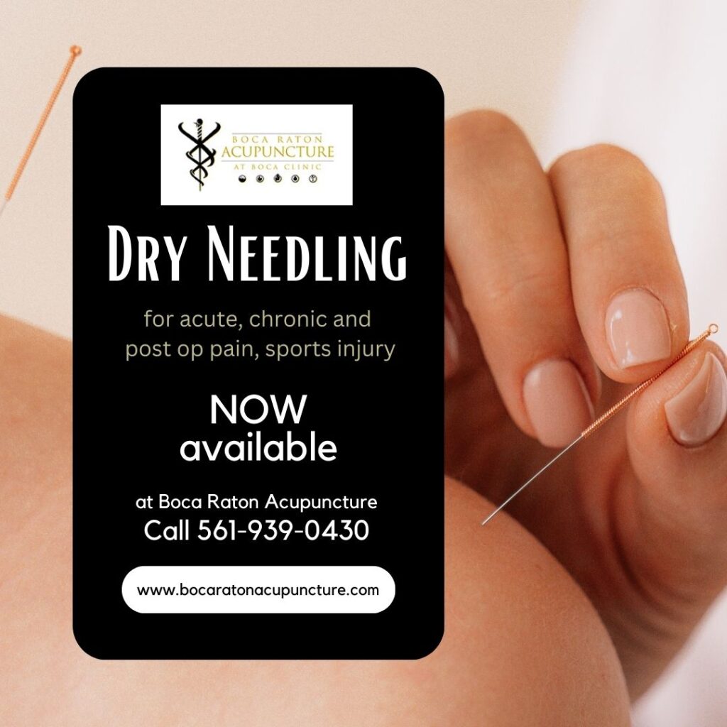 Dry Needling in Boca Raton Boca Raton Acupuncture